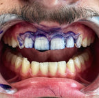 Maison-Veluxe™ Sérum Blanchissant V34