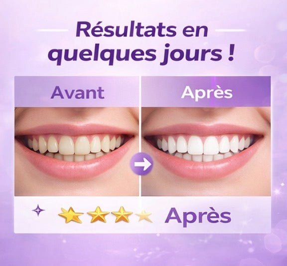 Maison-Veluxe™ – Bandes blanchissantes violettes