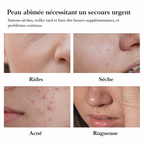 Maison-Veluxe™ Masques de Nuit Éclat Vitamine C (30 pièces)